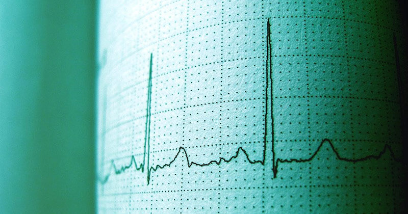 Heart rate monitor shows signs of life.